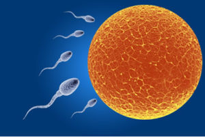 精子と卵子の受精を防ぐIUD